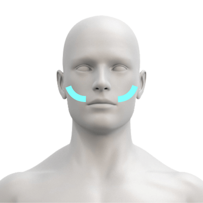 Laser Hair Removal for Men's Beard Line